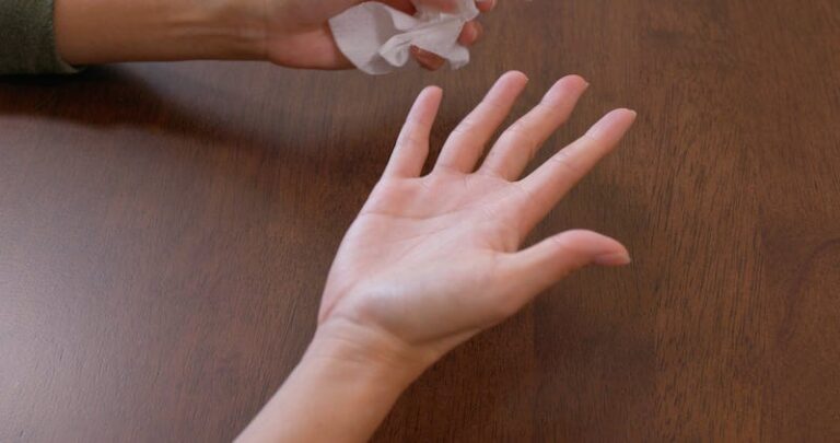 Why are my hands always so sweaty 